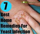 Home Remedies Yeast Infection Mouth Photos