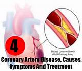 Coronary Artery Disease Home Remedies Pictures