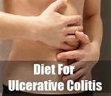 Diet And Home Remedies For Colitis Images