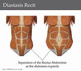 Pictures of Rectus Abdominis Workout Exercises