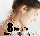 Cervical Spondylitis Home Remedies Pictures