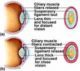 Photos of Eye Muscle Exercises