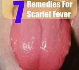 Pictures of Scarlet Treatment Side Effects