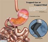 Pictures of What Causes Trapped Gas Pain
