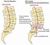 Images of Medication For Nerve Pain In Back