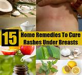 Pictures of Dog Rashes Home Remedies