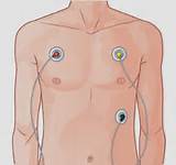 Heart Monitor Leads Images