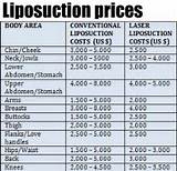 Prices For Liposuction Pictures