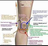 When To See A Doctor For Knee Pain Photos