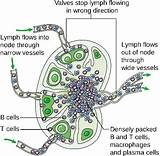 What Is A Lymph Node Doctor Called Images