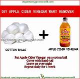 Warts Home Remedies Apple Cider Vinegar Images