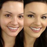 Best Makeup To Cover Up Acne Images