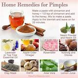 Natural Healing Home Remedies Photos