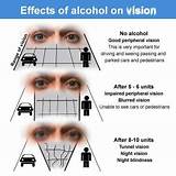 Pictures of Medical Effects Of Alcohol