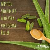 Photos of Aloe Vera Eczema Treatment