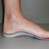 Images of Custom Made Shoe Orthotics