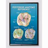 Images of Orthodontic Posters