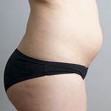 Photos of Bloated Belly And Gas Symptoms