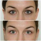Photos of How To Remove Eye Makeup With Coconut Oil