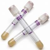 Blood Collection Tubes For Plasma Pictures