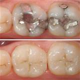 Silver Ranch Dental Images