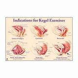 Images of Kegel Pelvic Muscle Exercise