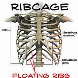 Photos of Floating Rib Pain Treatment