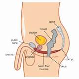 Images of Radical Prostatectomy Pelvic Floor Exercises