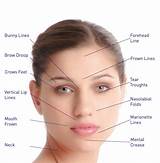 Facial Skin Treatments Wrinkles Pictures