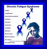 What Is The Treatment For Chronic Fatigue Syndrome