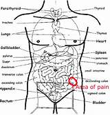 Lower Abdominal Pain Lower Left Side Pictures