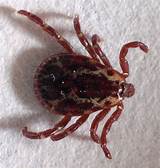 Wood Tick Pictures