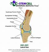 Knee Joint Therapy Images