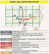 Images of Ecg Notes For Medical Students
