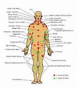 Photos of Self Defense Pressure Points