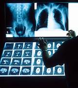 Photos of Medical Radiologic Technology Salary