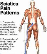 Pictures of Best Doctor For Sciatica Pain