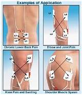 Electric Therapy For Back Pain Photos