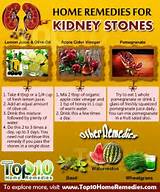 Photos of Kidney Stone Home Remedies That Work