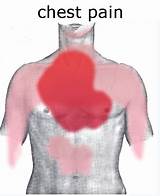Gas Related Chest Pain Pictures