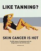 Images of Skin Cancer Life Insurance
