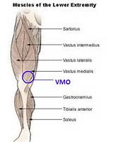 Vmo Muscle Strengthening Exercises Pictures