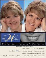 Dental Care For Low Income Nashville Tn