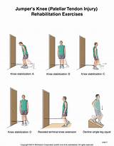 Images of Shin Splints Physical Therapy Protocol