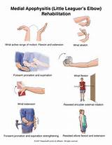 Photos of Wrist Muscle Strengthening Exercises