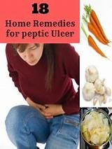 Images of Peptic Ulcer Home Remedies