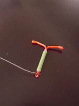 Iud Removal Spotting Images