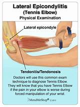Physical Therapy For Tennis Elbow Tendonitis