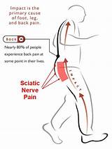 Photos of Pain In Lower Back On One Side Only