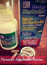Supplements For Psoriasis Treatment Pictures